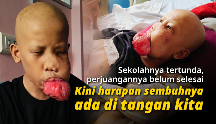 Tumor Membesar! Dani Kesulitan Makan dan Berbicara