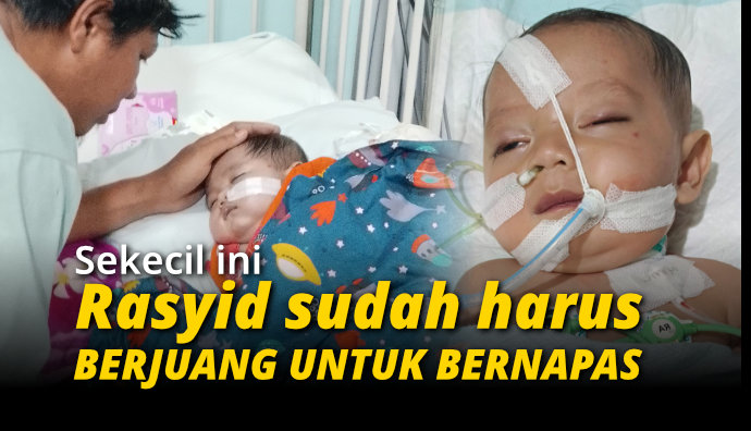 Jantung Bocor dan Terancam Komplikasi ! Bantu Anak Penjual Sempol