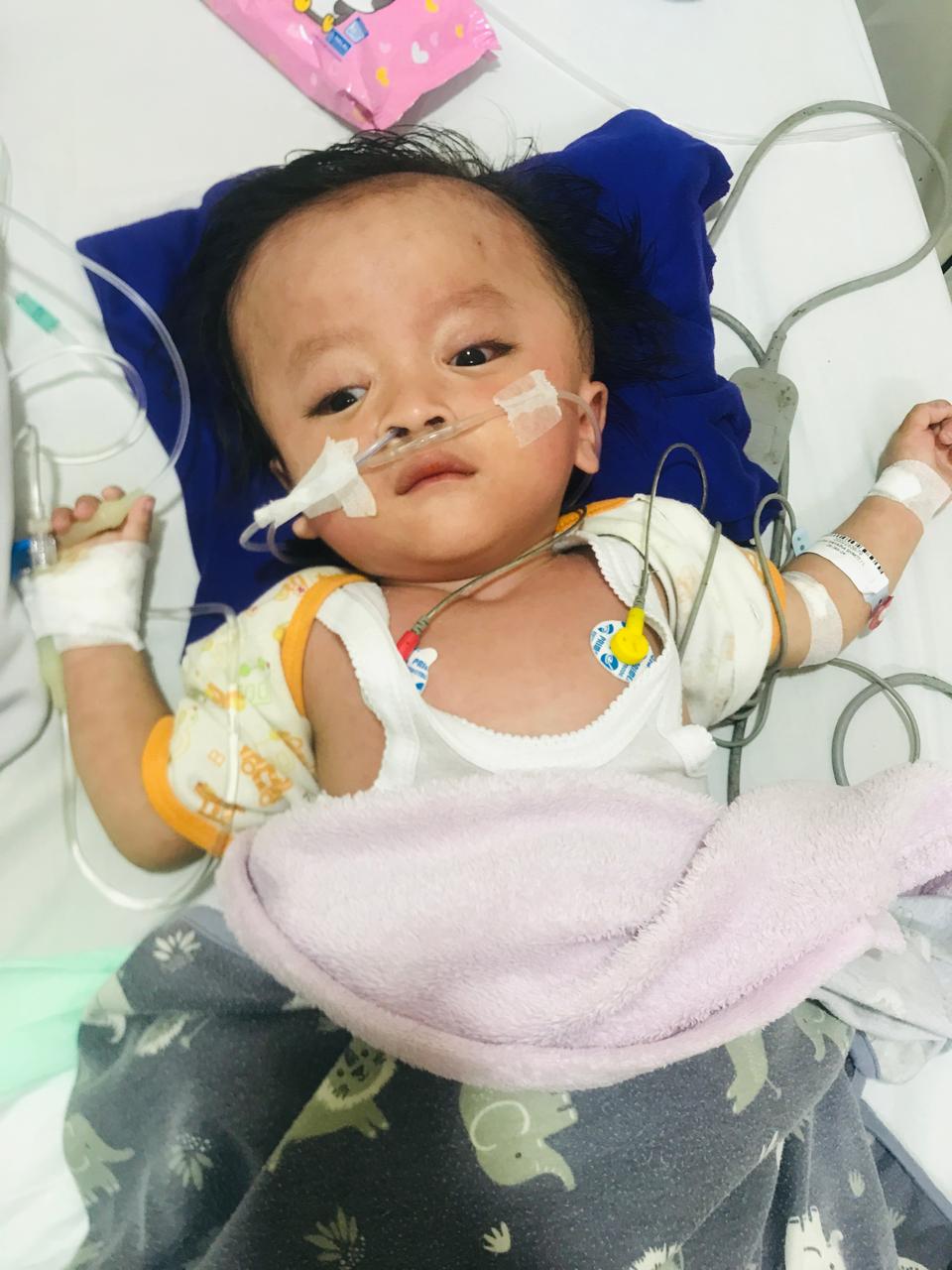 Saudara Kembarnya Meninggal, Bantu Gizan (2) Berjuang Sembuh