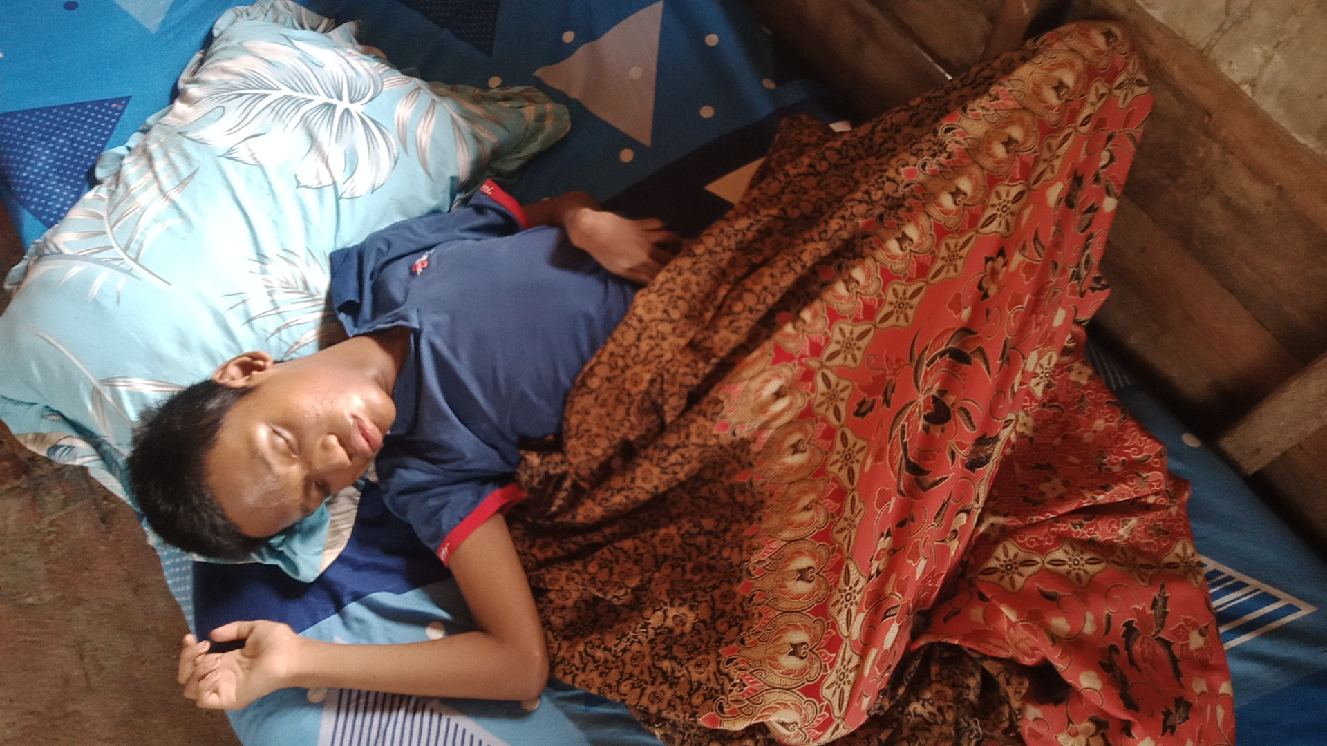Kejang Berulang Membuat Diki Berhenti Sekolah