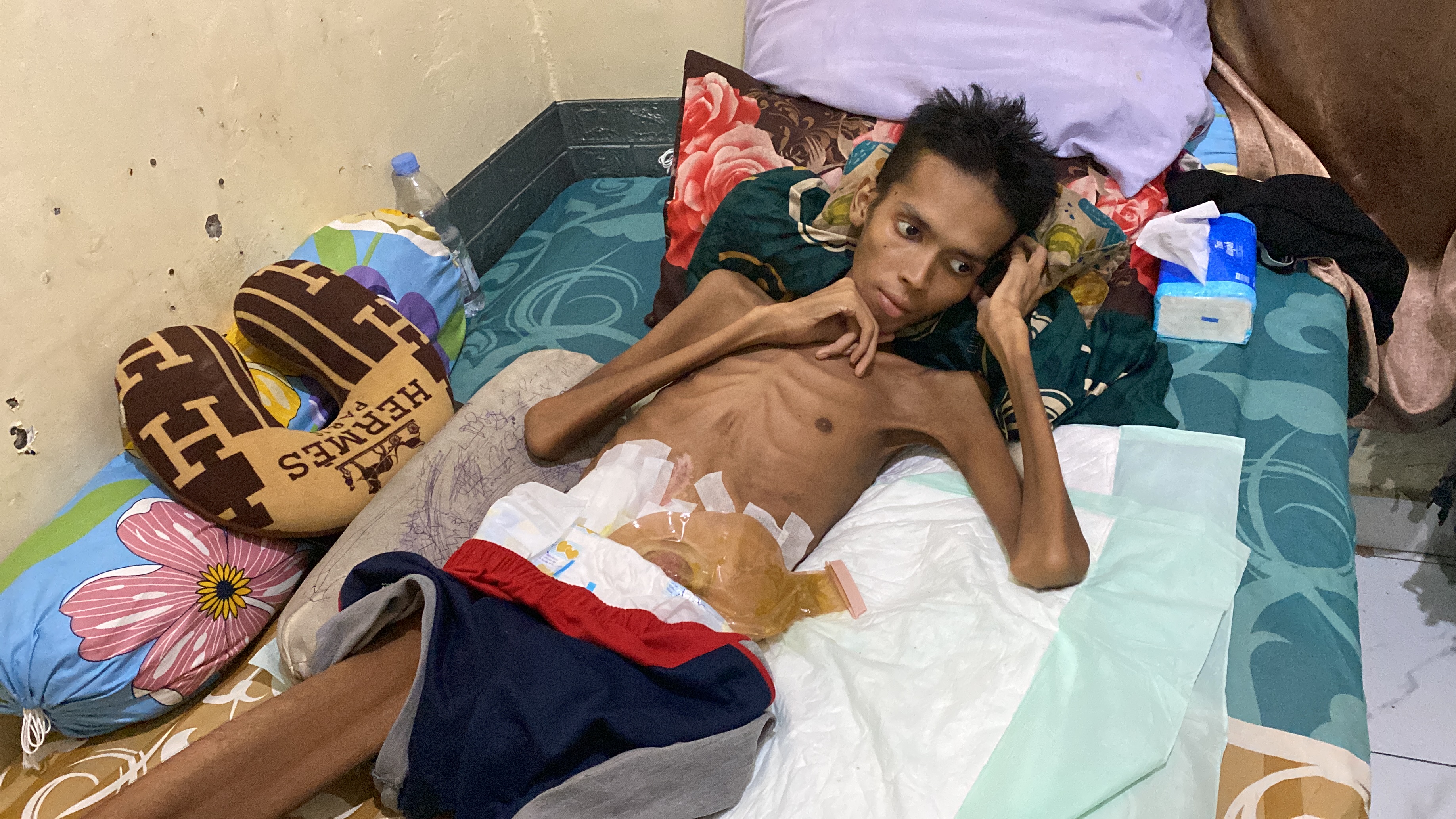 Bantu Rizky Sembuh dari Radang Usus Kronis